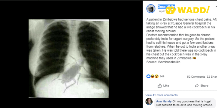 Debunked: Live Cockroach in Chest Xray is a doctored x-ray of Marilyn Monroe