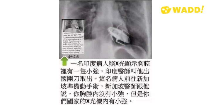 Debunked: Live Cockroach in Chest Xray is a doctored x-ray of Marilyn Monroe
